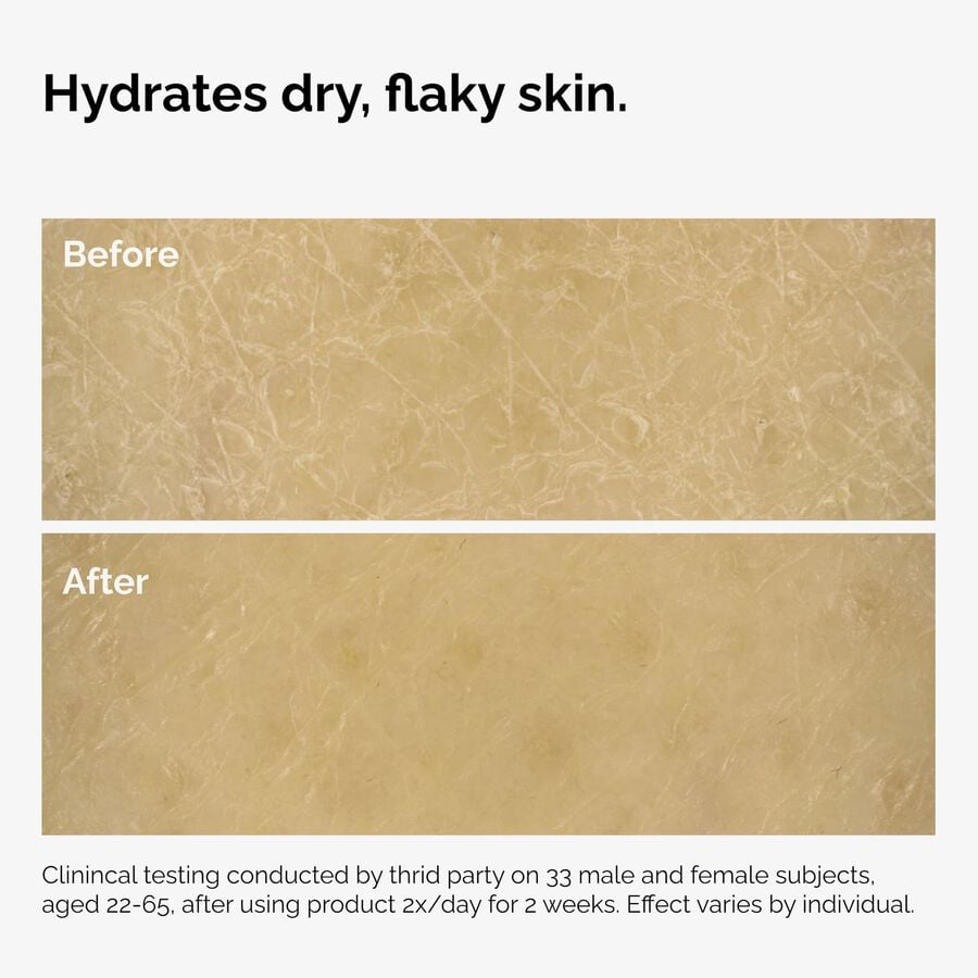 the-body-care-collection-y8 ord-natural-moisturizing-factors-inulin-body-before-after-graphic-02.jpg