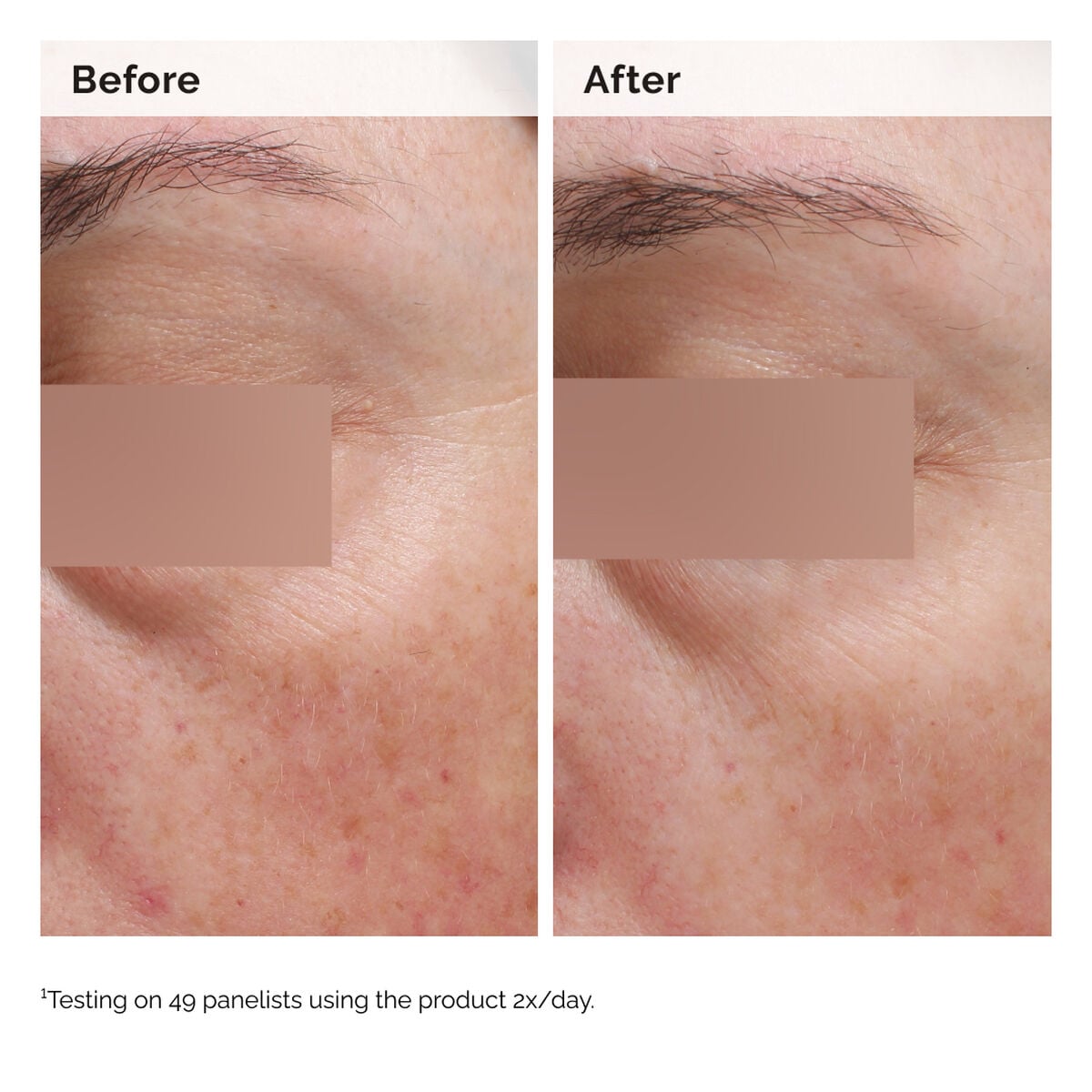 niacinamide-5-face-and-body-emulsion-f4 2024-08-23-ORD-Nia-5pct-Face-Body-B-A-Elasticity-Global-02-1x1.jpg