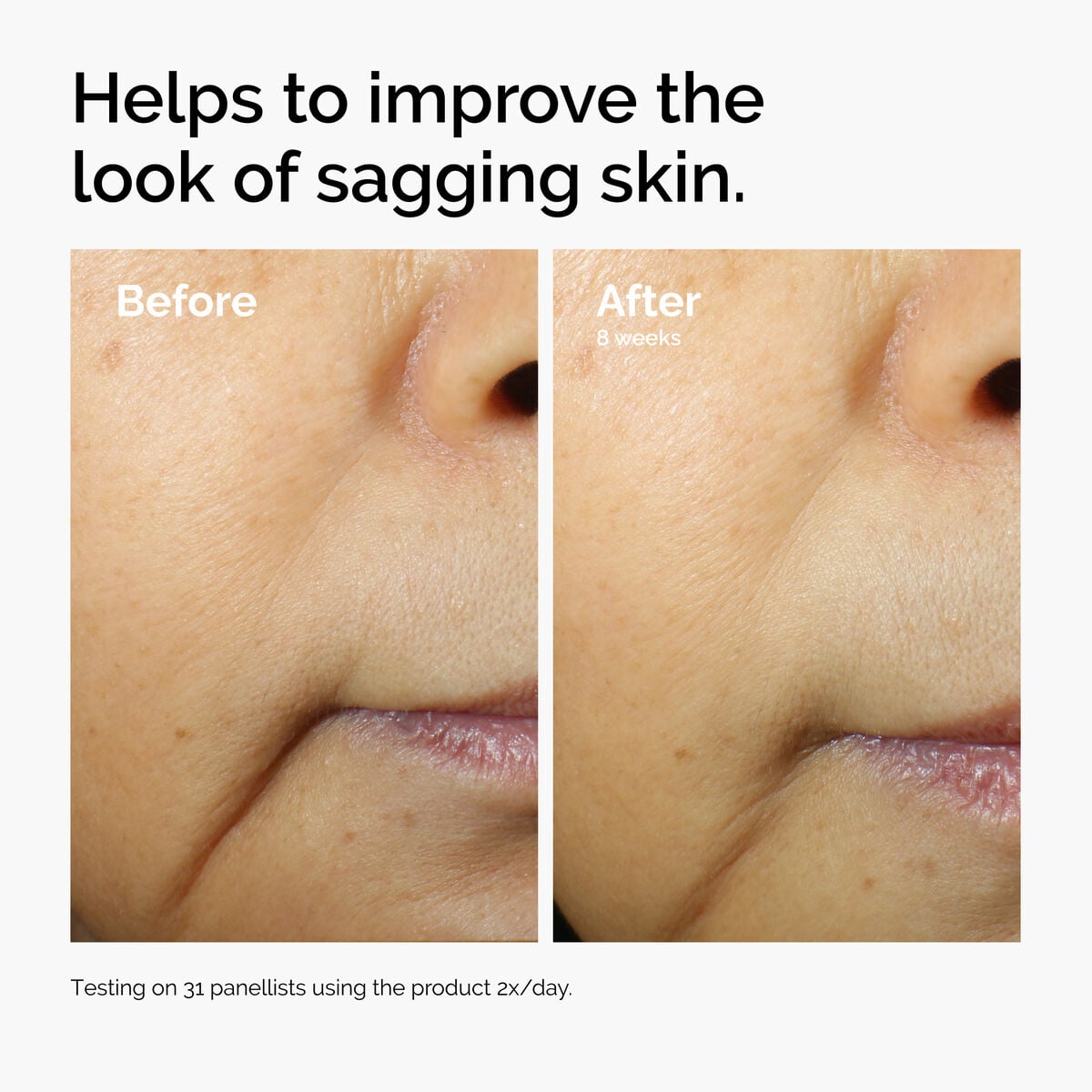 caffeine-3-escin-1-face-serum-m6 ord-caffeine-3pct-escin-1pct-face-serum-before-after-sagging.jpg