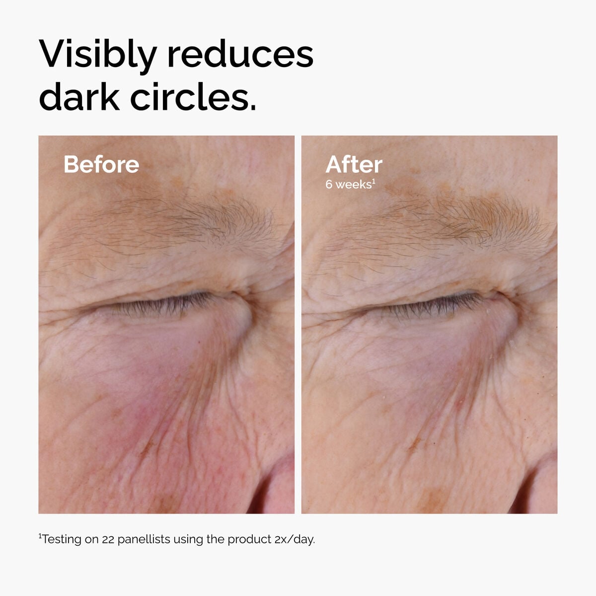 caffeine-solution-5-egcg-eye-serum-h9 ord-caffeine-solution-egcg-dark-circles-before-after.jpg