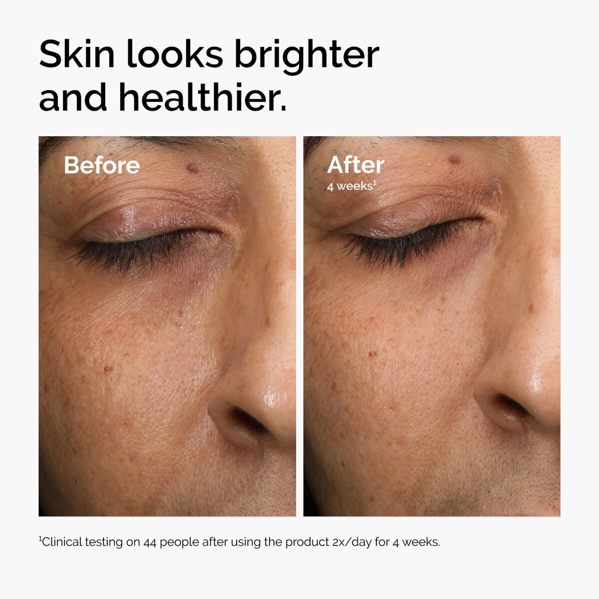 multi-antioxidant-radiance-serum-o2 ord-mars-before-after-healthy.jpg