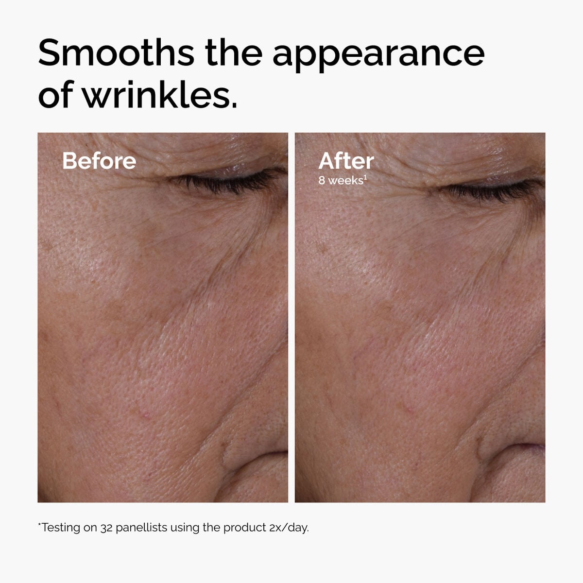 multi-peptide-ha-serum-m7 ord-multi-peptide-ha-serum-wrinkles-before-after.jpg
