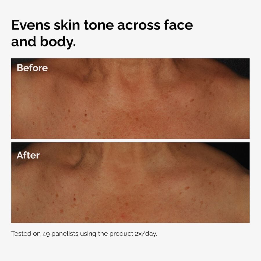 the-body-care-collection-y8 ord-niacinamide-face-body-serum-before-after-even-tone-graphic.jpg