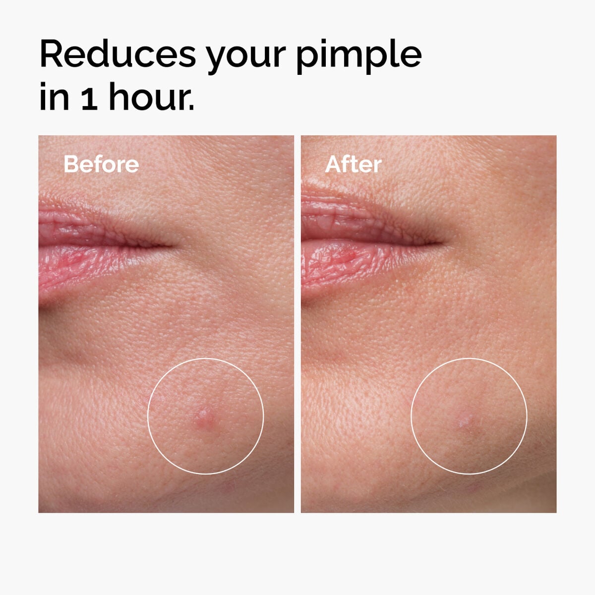 sulfur-10-powder-to-cream-concentrate-y5 ord-sulfur-10pct-powder-to-cream-concentrate-before-after-NA.jpg